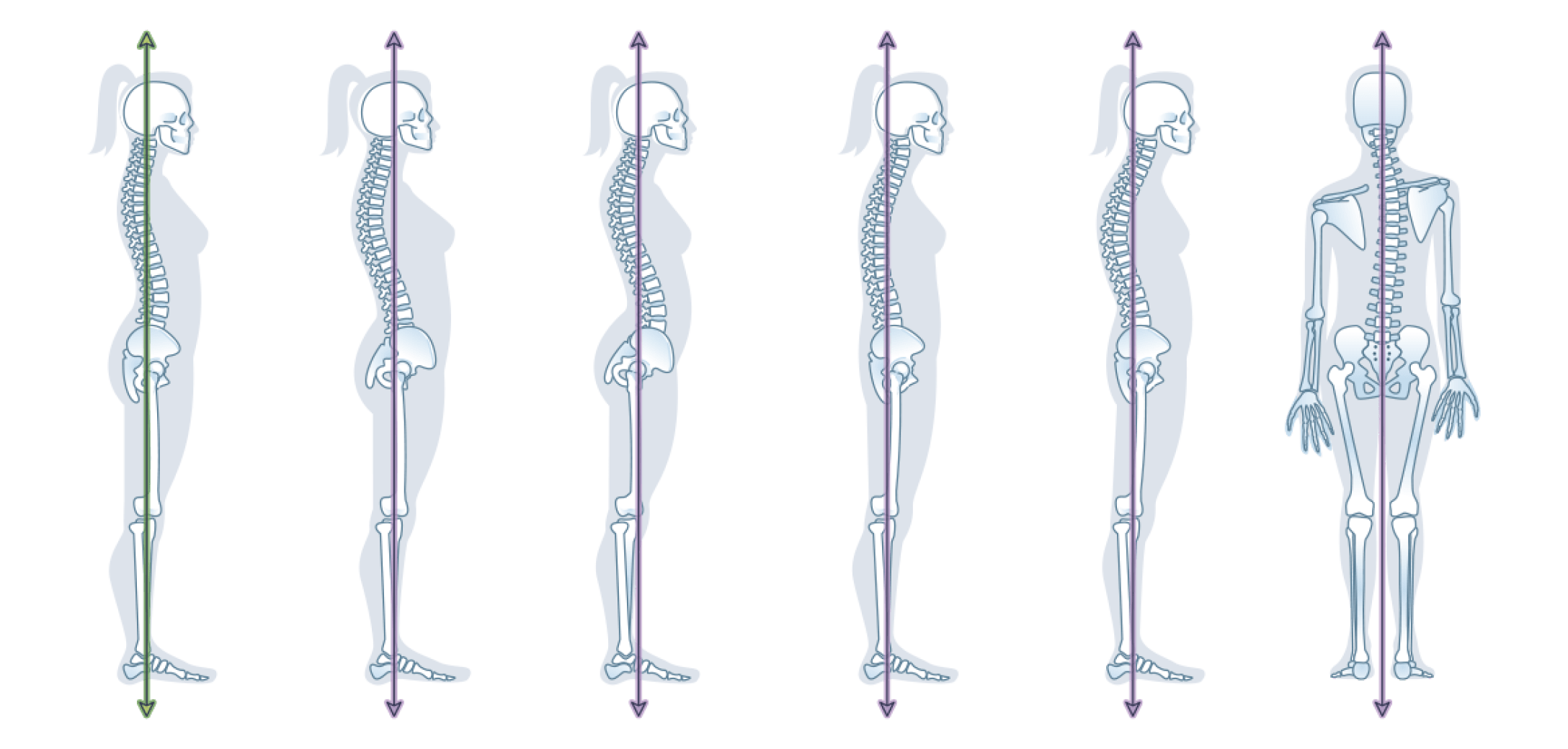 Коррекция осанки. Стандартный доступ - Видеокурс Ревитоники